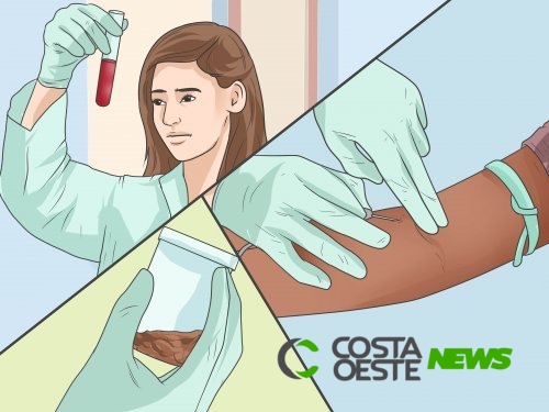 7 sinais precoces de câncer colorretal que não se deve negligenciar